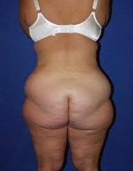 huge fat butt lose fat women